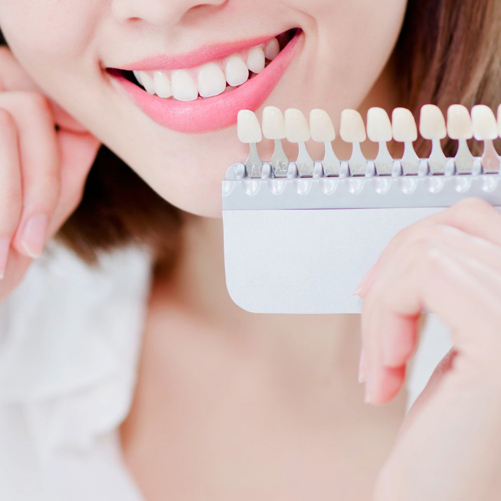 Teeth Whitening